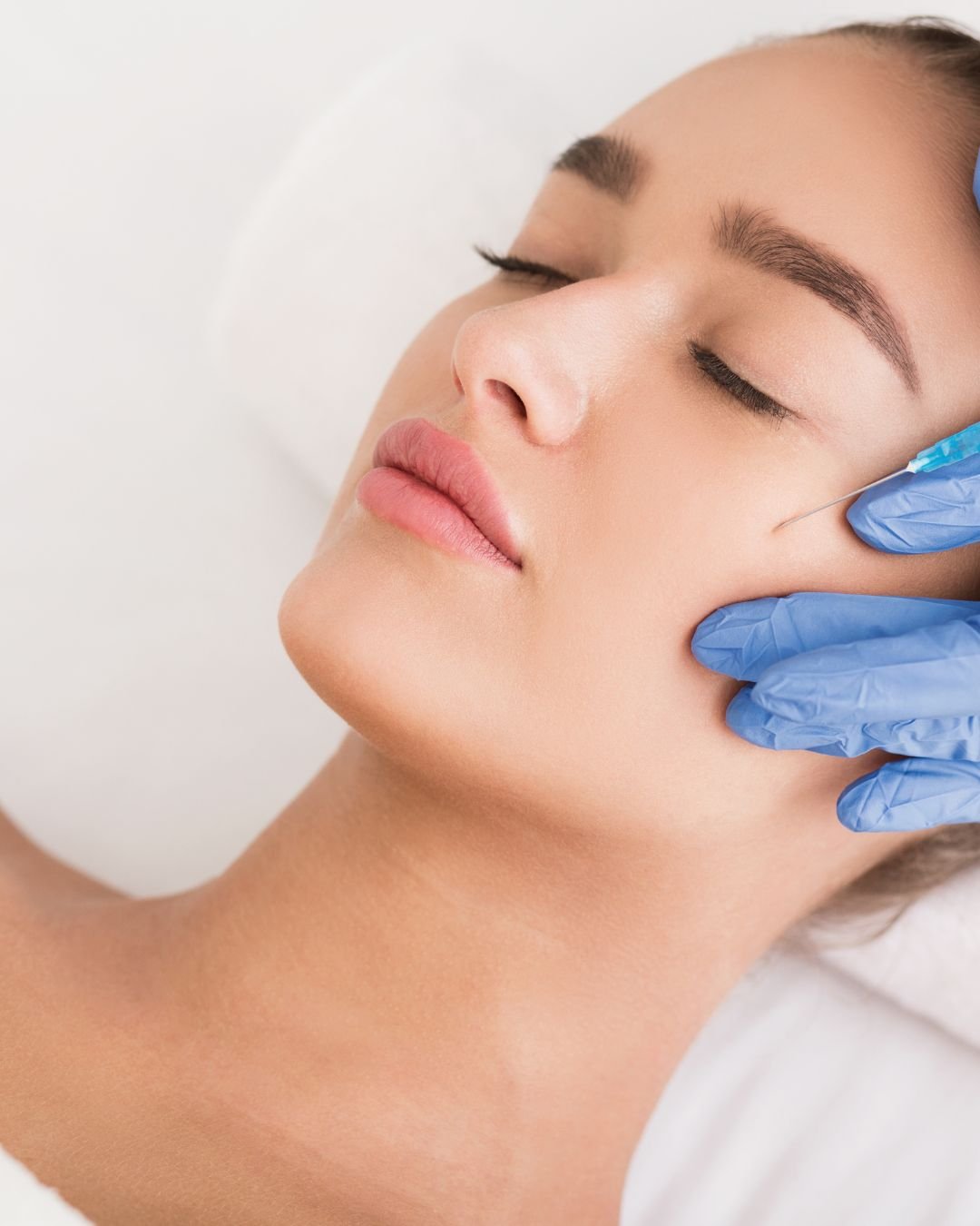 Noble Face Regénère – ÁCIDO POLILÁCTICO (PLLA)